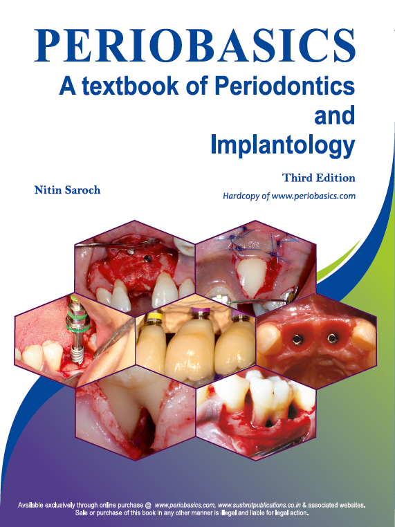 periobasics-a-textbook-of-periodontics-and-implantology-second-edition-by-doctor-nitin-saroch
