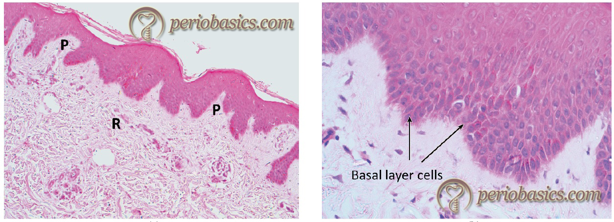 Oral mucosa at low power magnification demonstrating stratified squamous epithelium overlying the papillary (P) and reticular (R) lamina propria and submucosa