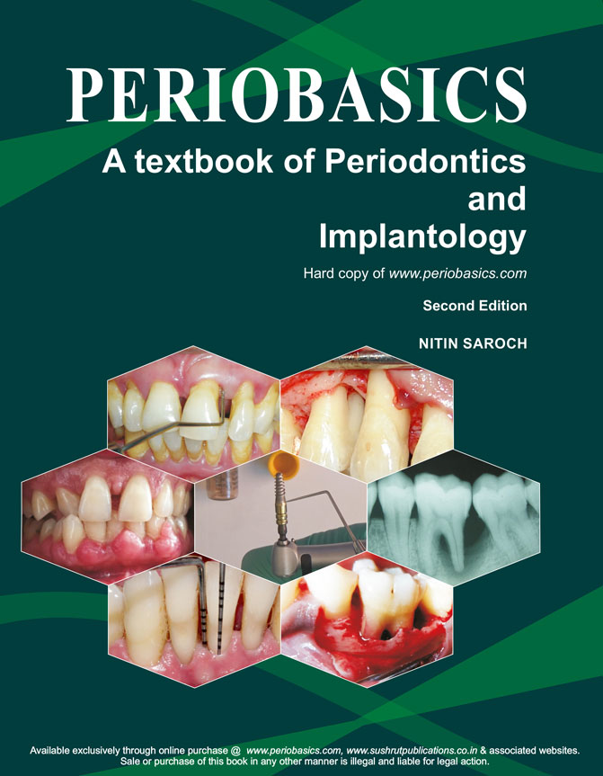 periobasics-a-textbook-of-periodontics-and-implantology-second-edition-by-doctor-nitin-saroch