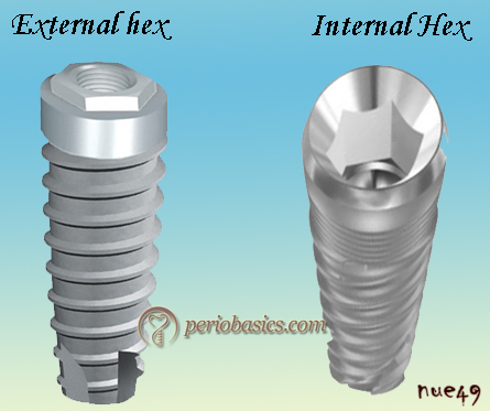 External and internal hex connections