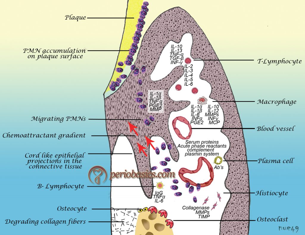 Periodontal Pocket – Periobasics.com