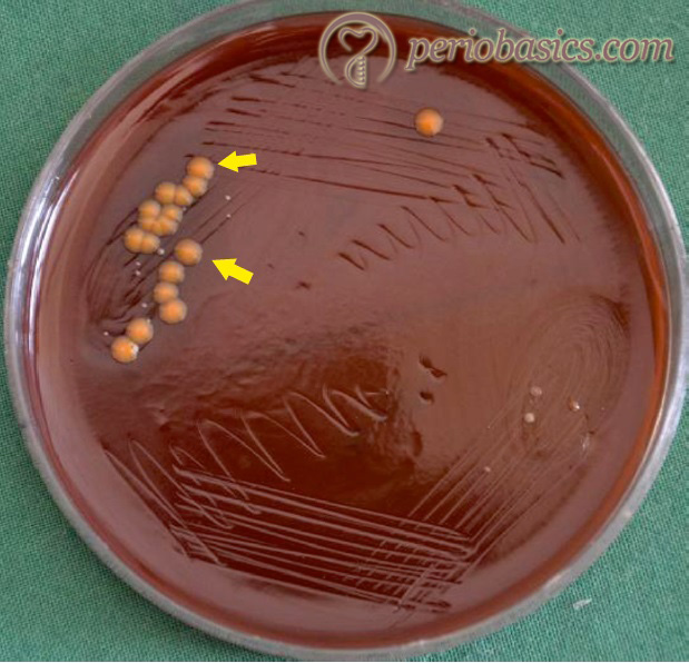 The colony characteristics of Capnocytophaga species on blood agar. (Courtesy Dr. Bibina George).