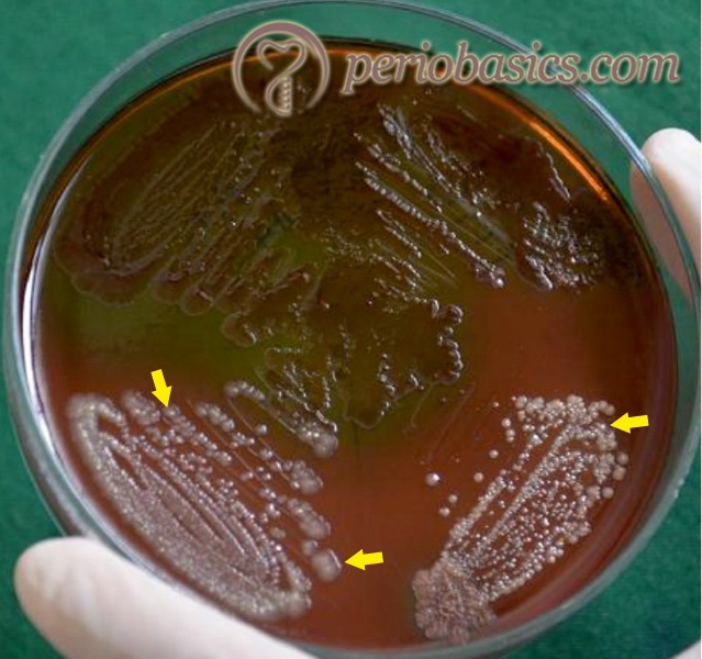 The colony characteristics of Fusobacterium nuclea-tum on CVE agar . (Courtesy Dr. Bibina George).