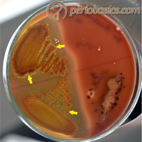 The colony characteristics of Prevotella intermedia on blood agar. (Courtesy Dr. Bibina George).