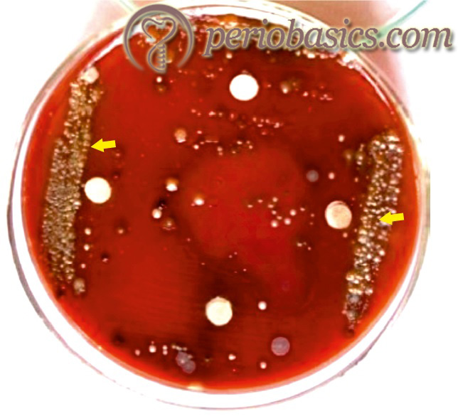 The colony characteristics of Tannerella forsythia on blood agar. (Courtesy Dr. Bibina George).