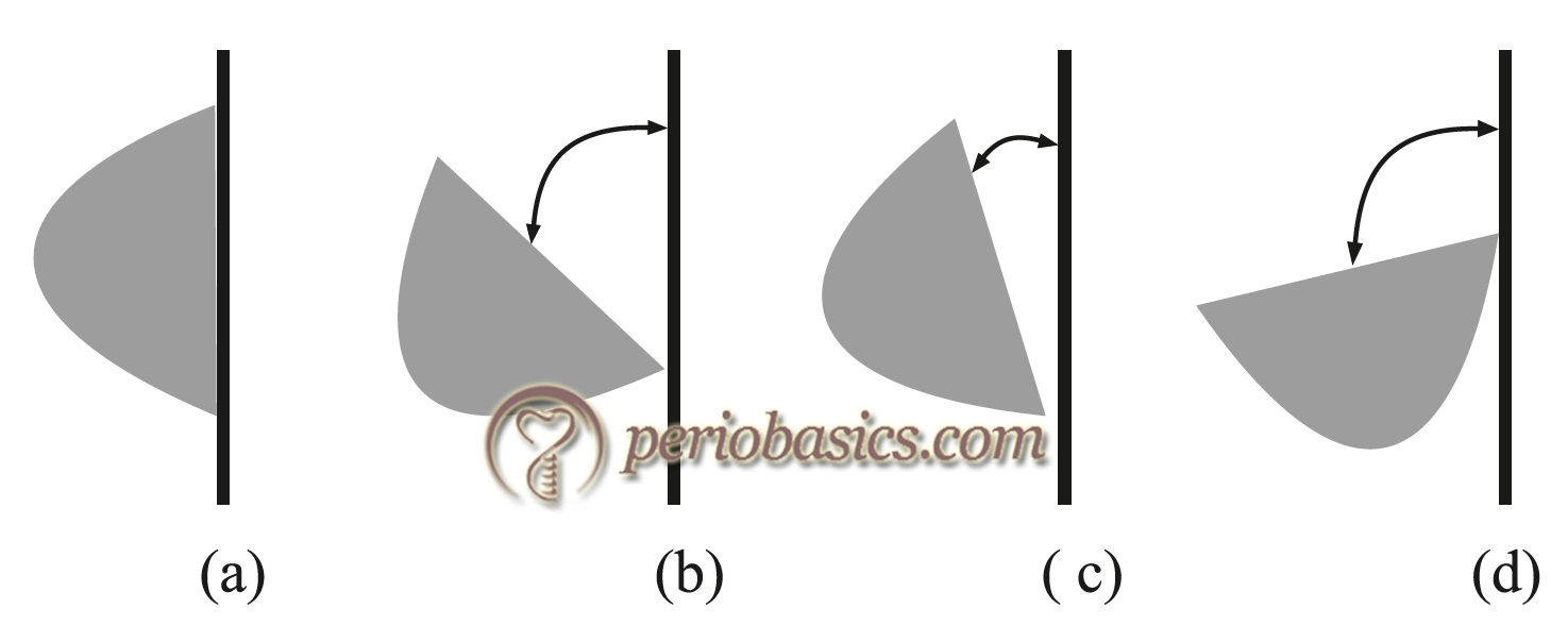 Diagrammatic representation of instrument activation.