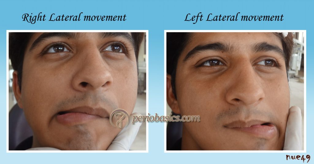 Lateral movements of mandible
