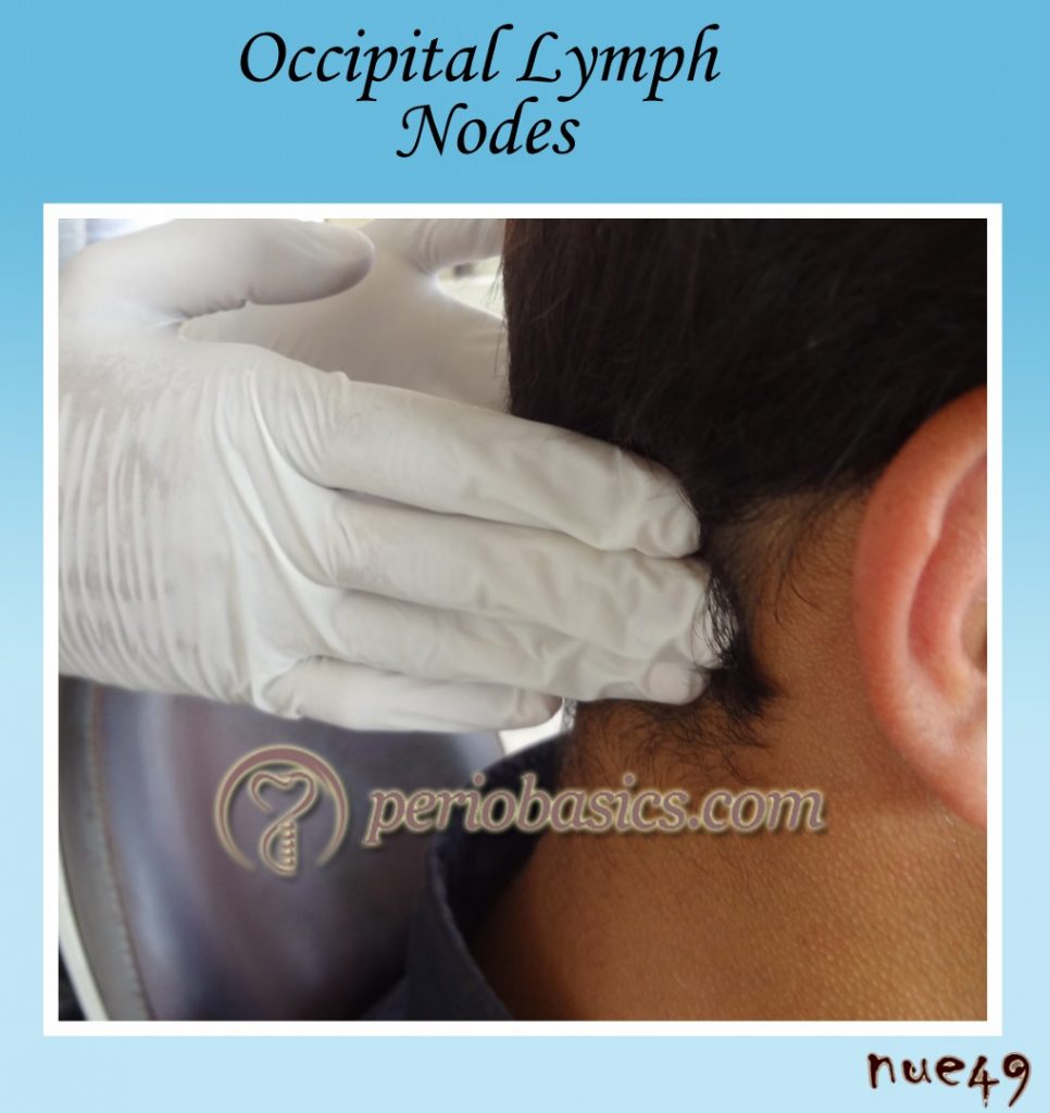 Occipital Lymph nodes