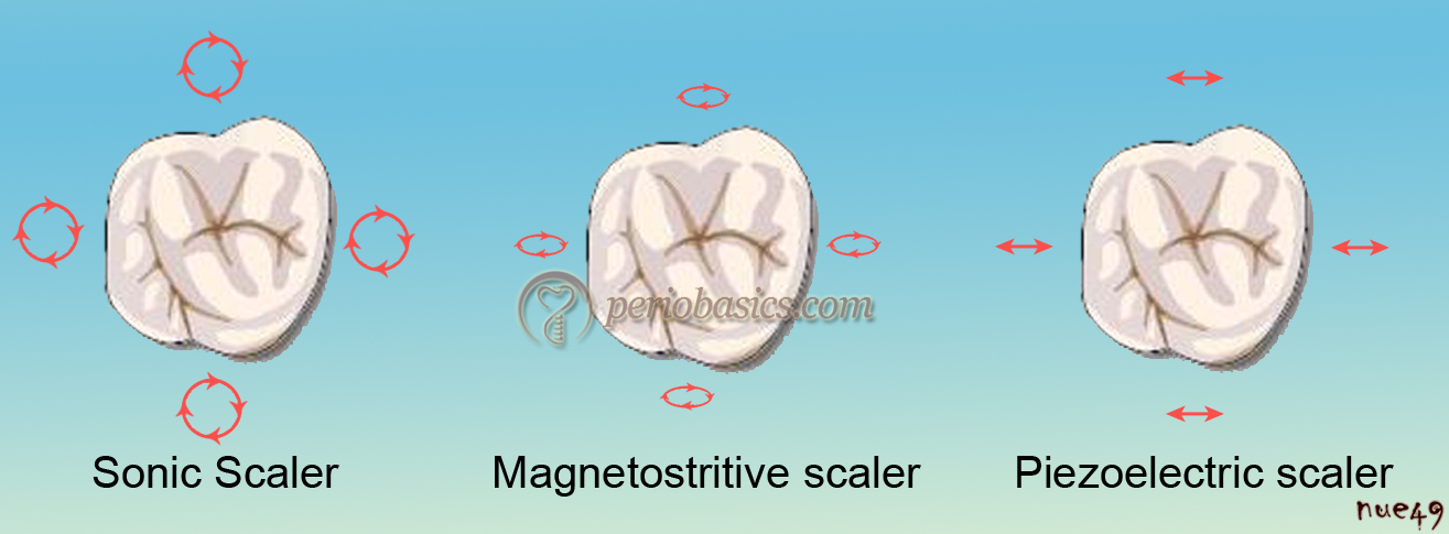 Scaler tip movement in different scalers