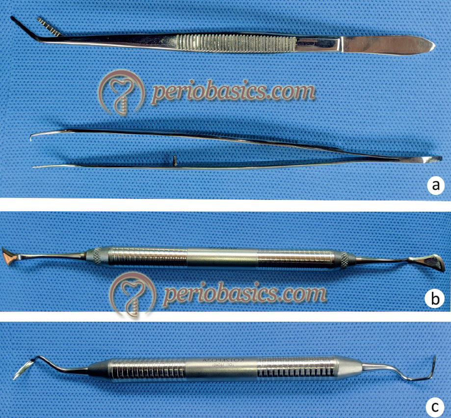 Instruments used in gingivectomy (a) Crane Kaplan pocket marker, (b) Kirkland knife, (c) Orbans knife. (Courtesy Dr. Aneen Suresh)