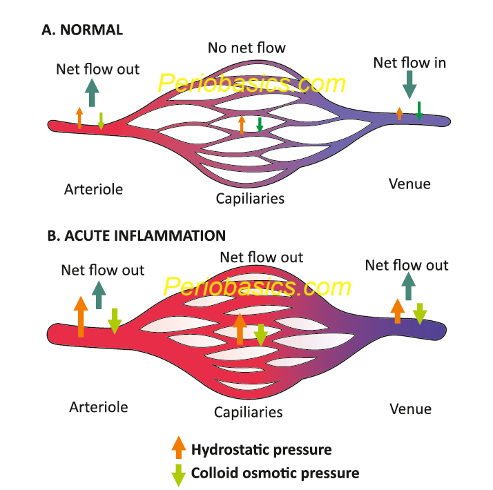 Changes observed in vascular bed during inflammation